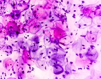 cellules hpv